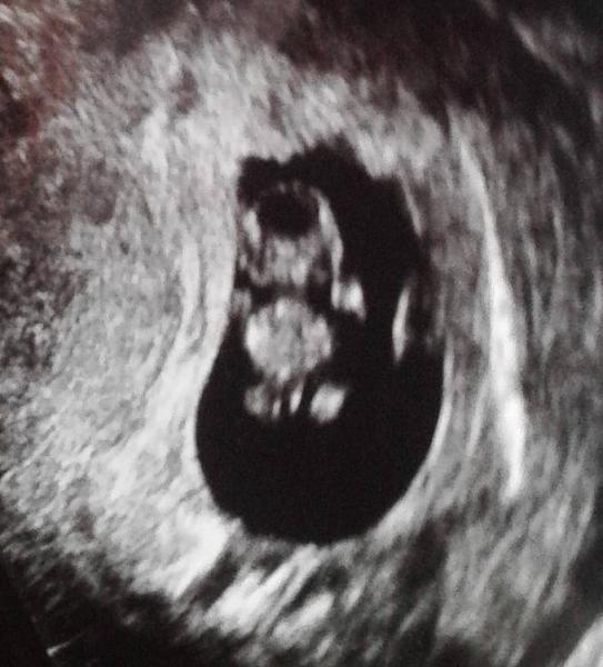 Bild zu FA Termin - Forum für August - Mamis