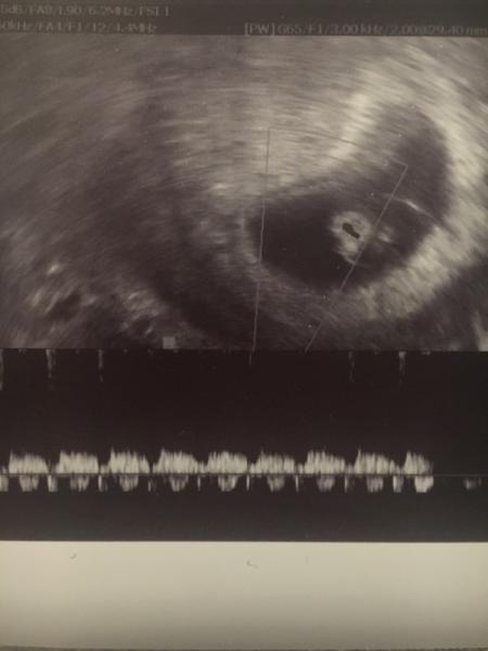 Bild zu FA und Erleichterung - Forum für August - Mamis