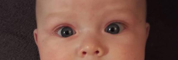 Bild zu Ist das eine Bindehautentzündung? - Kennt sich jemand damit aus? - Forum für August - Mamis