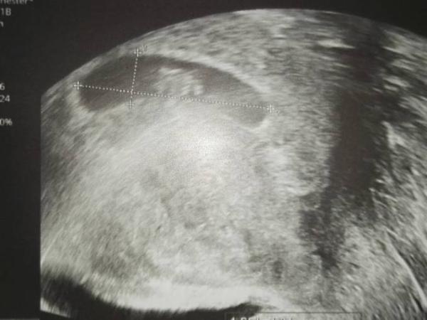 Bild zu Termin heute - Forum für August - Mamis