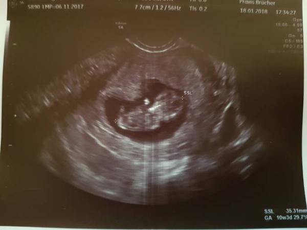Bild zu Termin geschafft - Forum für August - Mamis