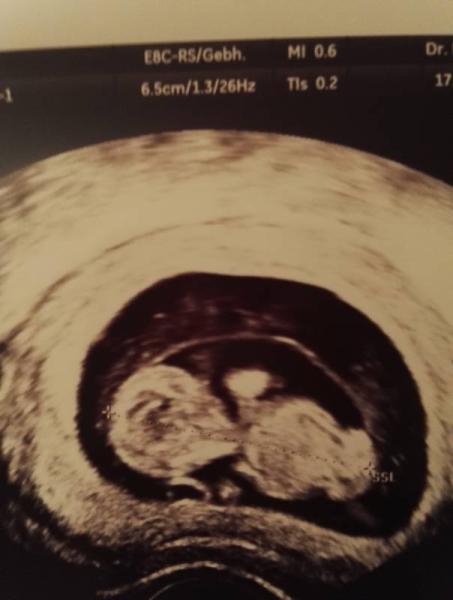 Bild zu FA Termin 💟💙 - Forum für August - Mamis
