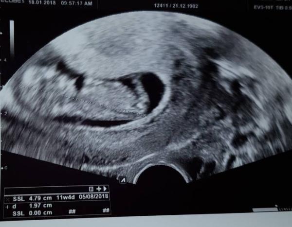 Bild zu Bin auch noch da ;-) - Forum für August - Mamis