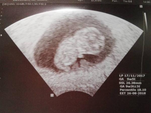 Bild zu Endlich FA Termin - Forum für August - Mamis