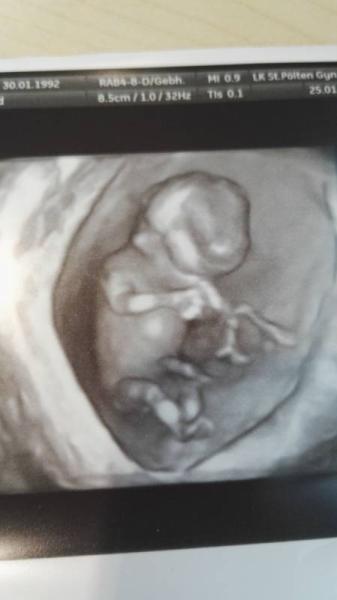 Bild zu NFM 3D Bild - Forum für August - Mamis