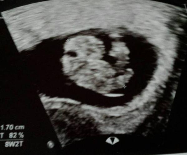 Bild zu Hypochonder par excellence - Forum für August - Mamis