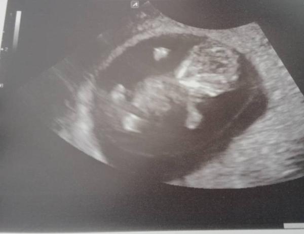 Bild zu Geschafft - Forum für August - Mamis