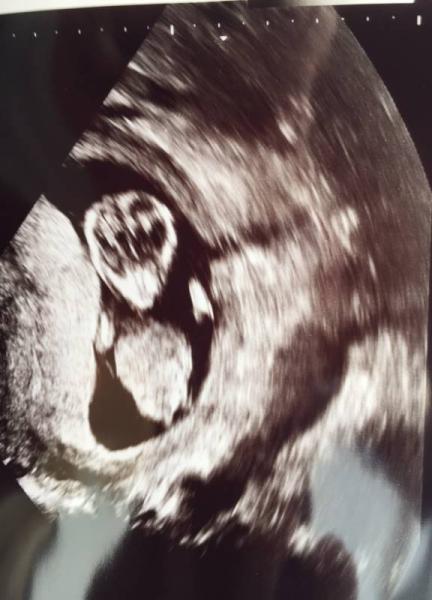 Bild zu So glücklich! - Forum für August - Mamis