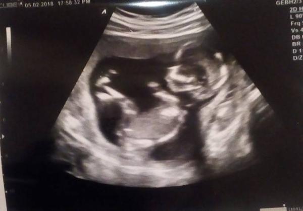 Bild zu Hier kommt mein... - Forum für August - Mamis