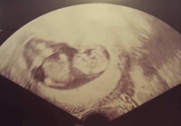 Bild zu Auch zurück - Forum für August - Mamis