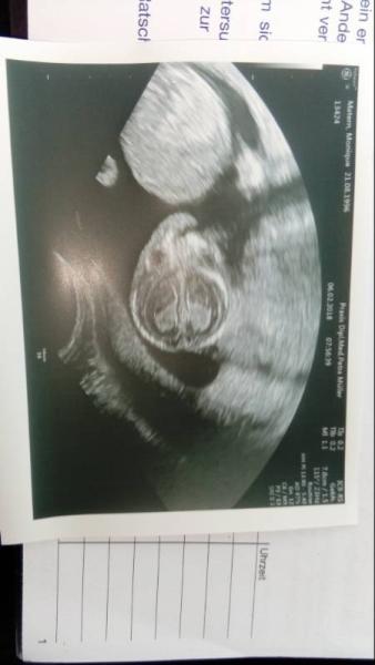Bild zu Ultraschall Bild normal ? - Forum für August - Mamis