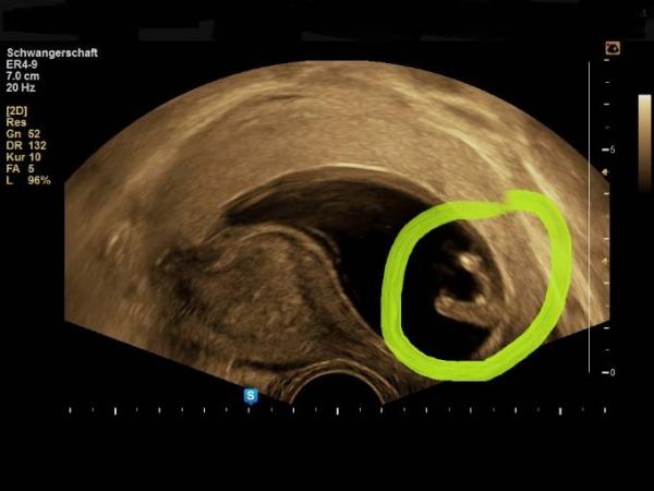 Bild zu Geschlecht - Forum für August - Mamis