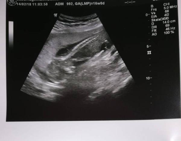 Bild zu FA Termin - Forum für August - Mamis