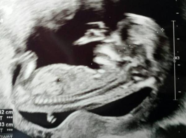 Bild zu Zurück vom FA - Forum für August - Mamis