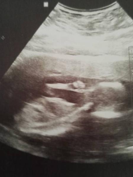 Bild zu Endlich wieder Gyntermin - Forum für August - Mamis