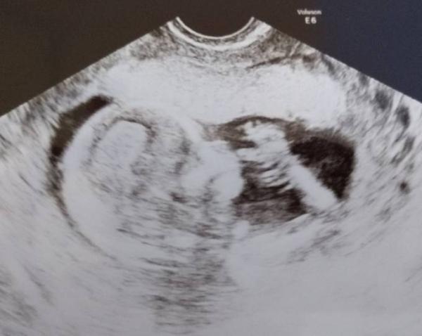 Bild zu Aufregende Zeit - Forum für August - Mamis