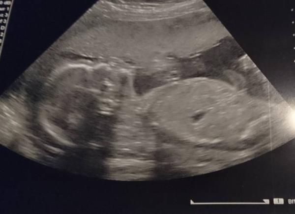 Bild zu Heute war wieder FA Termin - Forum für August - Mamis