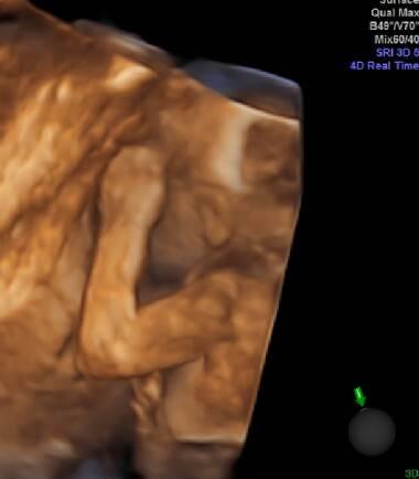 Bild zu 3d US  - Forum für August - Mamis