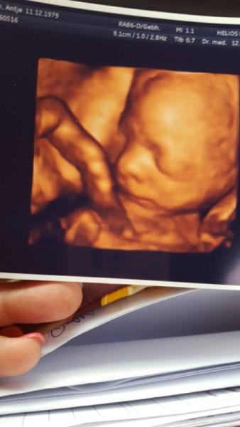Bild zu Danke für die Daumen 😘 - Forum für August - Mamis