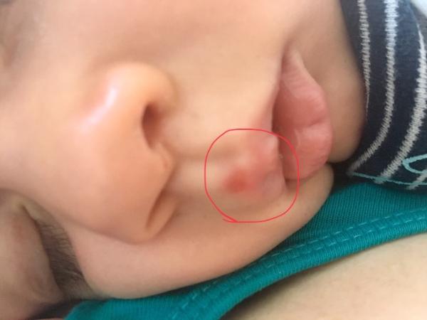 Bild zu Was könnte das sein? - Forum für August - Mamis