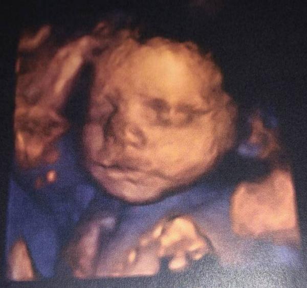 Bild zu Update Krankenhaus - Forum für August - Mamis