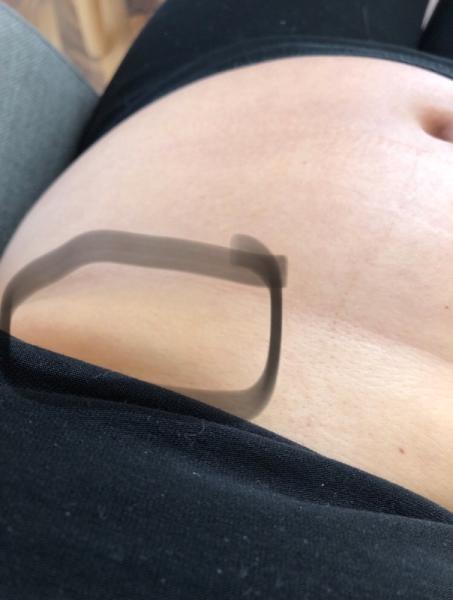 Bild zu Rippen, haut oder oberbauch - Forum für August - Mamis