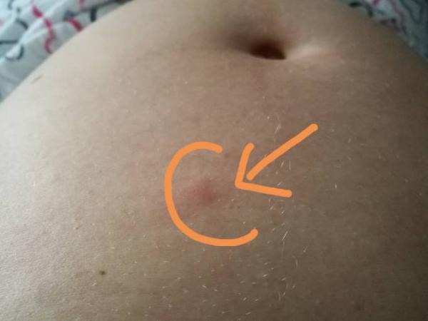 Bild zu Seltsame Erscheinung - Forum für August - Mamis