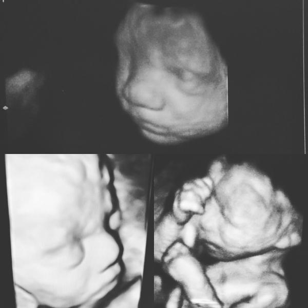 Bild zu Heidi...ehhm Frau Doktor hatte heute ein Foto für uns! - Forum für August - Mamis