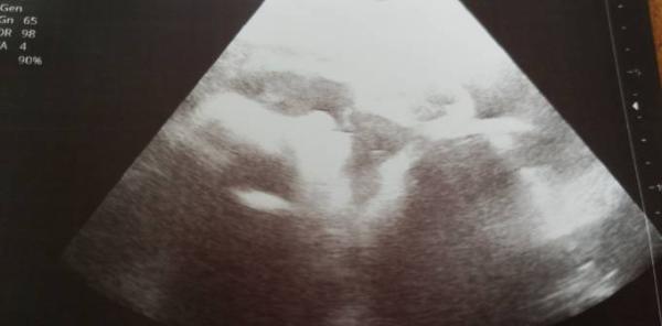 Bild zu Vu und gute Nachrichten - Forum für August - Mamis