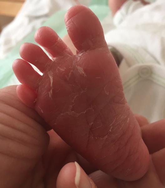 Bild zu Unser "Ü-Ei" ist ein Junge 😊 - Forum für August - Mamis