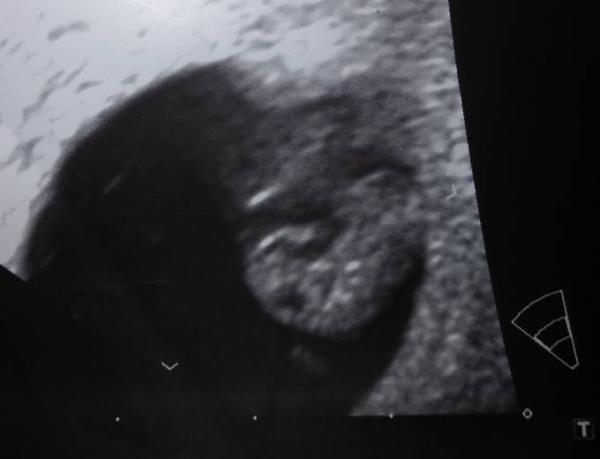 Bild zu Überglücklich - Forum für August - Mamis