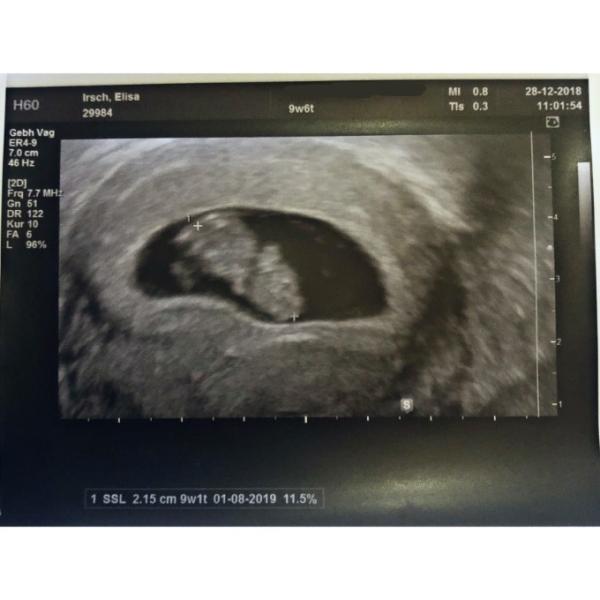 Bild zu Ultraschall - Forum für August - Mamis