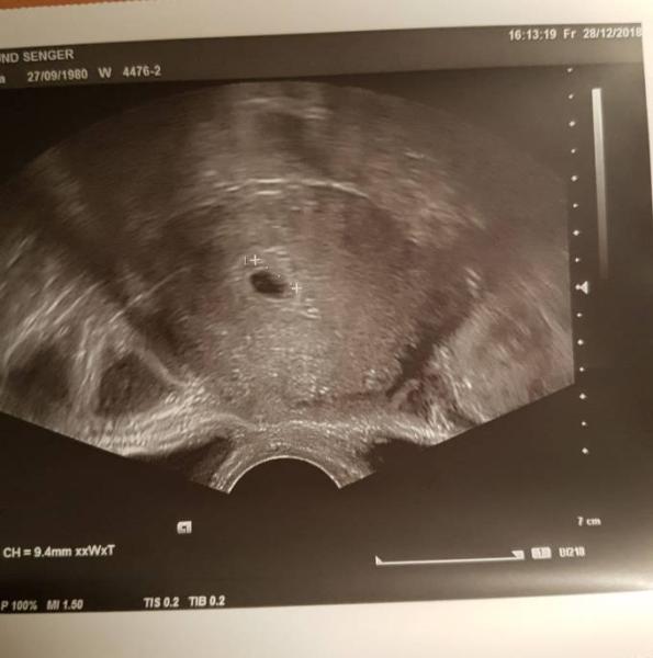 Bild zu Ein Fünkchen Hoffnung - Forum für August - Mamis