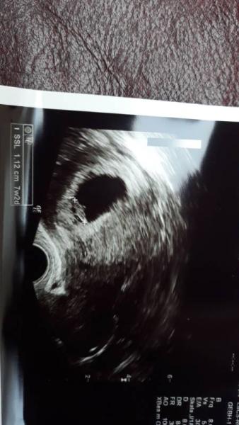Bild zu Update FA Termin mit Foto 😍 - Forum für August - Mamis