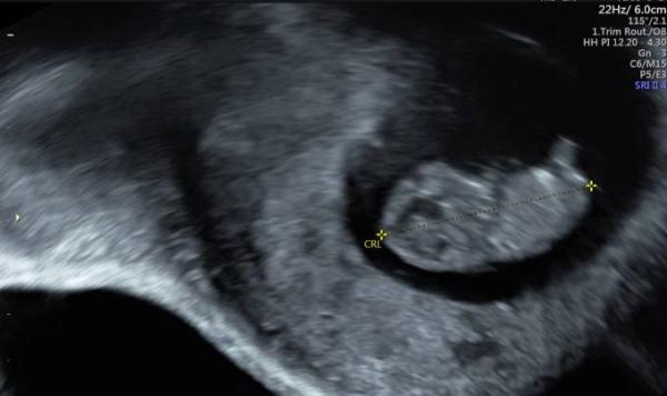Bild zu FA Termin - Forum für August - Mamis