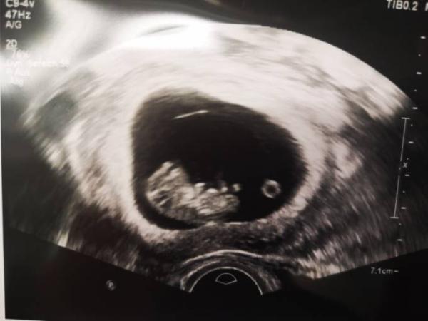 Bild zu FA Termin - Forum für August - Mamis