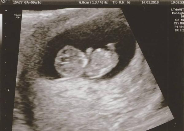 Bild zu Happy - Forum für August - Mamis