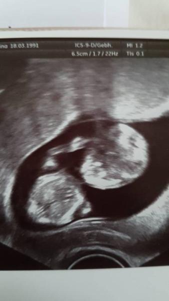 Bild zu FA-Termin - Forum für August - Mamis