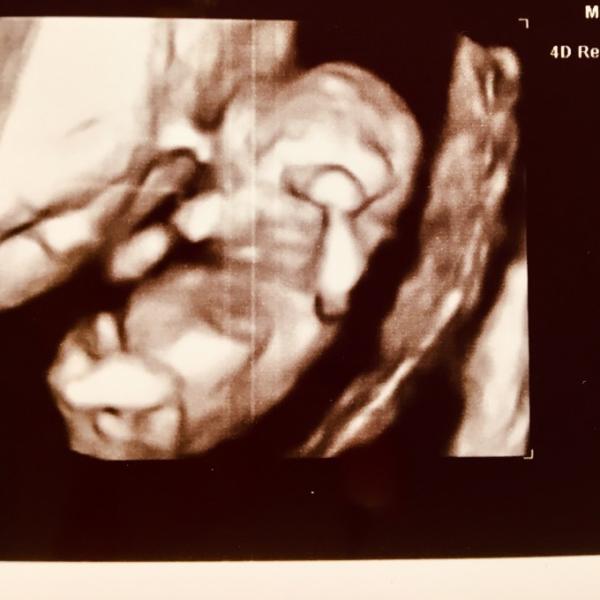 Bild zu Update... - Forum für August - Mamis