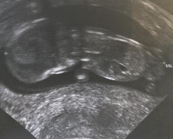 Bild zu Juhuu endlich - Forum für August - Mamis