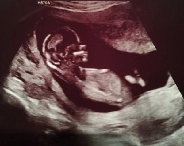 Bild zu Magen Darm Update mit Baby bild - Forum für August - Mamis