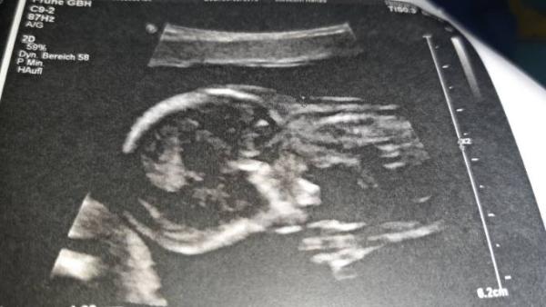Bild zu Was Lustiges... - Forum für August - Mamis