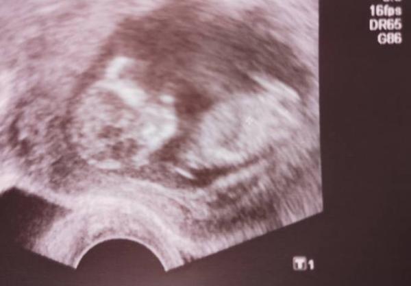 Bild zu Einfach glücklich - Forum für August - Mamis