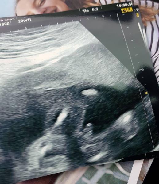 Bild zu Es wird ein.... - Forum für August - Mamis