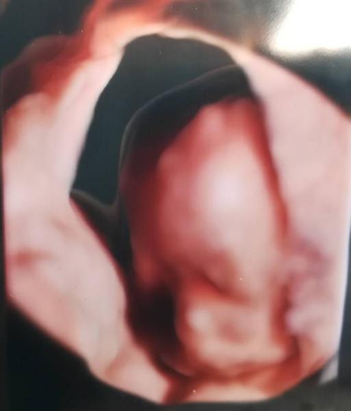 Bild zu Klinikaufenthalt und Feindiagnostik - Forum für August - Mamis