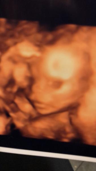 Bild zu wütend, traurig, scheiss ärzte - Forum für August - Mamis
