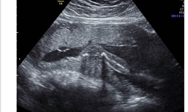 Bild zu US Bild erkennen - Forum für August - Mamis