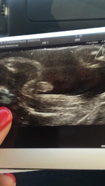 Bild zu Völlig verwirrt - Forum für August - Mamis