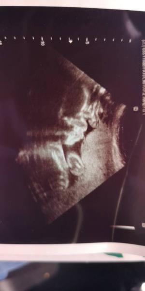 Bild zu VU :) - Forum für August - Mamis