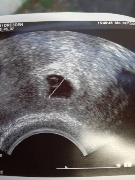 Bild zu 1. Ultraschall bei 5+1 - Forum für August - Mamis